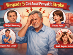 Waspada gejala awal penyakit stroke