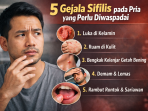 Kenali sejak dini gejala sifilis pada pria, mulai dari luka tanpa nyeri hingga ruam kulit.