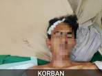 Polisi Amankan 2 Pelaku Pengeroyokan di Taman Serasan Muaradua, Korban Dibacok Berulang Kali
